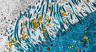 Épithélium nasal infecté par le SARS-COV-2