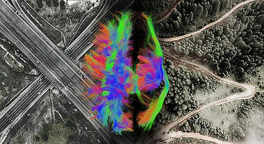 Un cerveau d’un enfant de 8 ans vivant avec une paralysie cérébrale et qui participe à sa recherche doctorale. L’image est posée en surimpression sur un montage comprenant des autoroutes, une route et un chemin de terre. Le cerveau est représenté par une multitude de petits fils colorés qui évoquent les routes de matière blanche dans le cerveau.