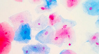 Image de cellules cancéreuses