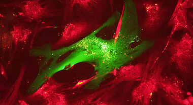 Fibroblaste et cellules endrothéliales