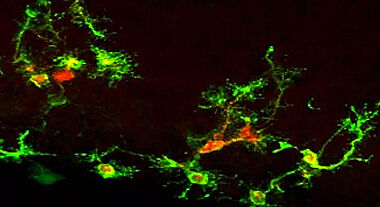 Lumière sur les cellules souches du cerveau adulte