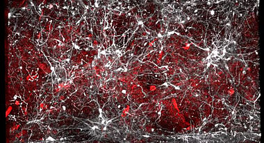 réseau vasculaire cérébral et neurones dopaminergiques