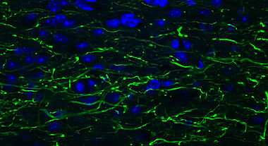Neurones moelle épinière souris