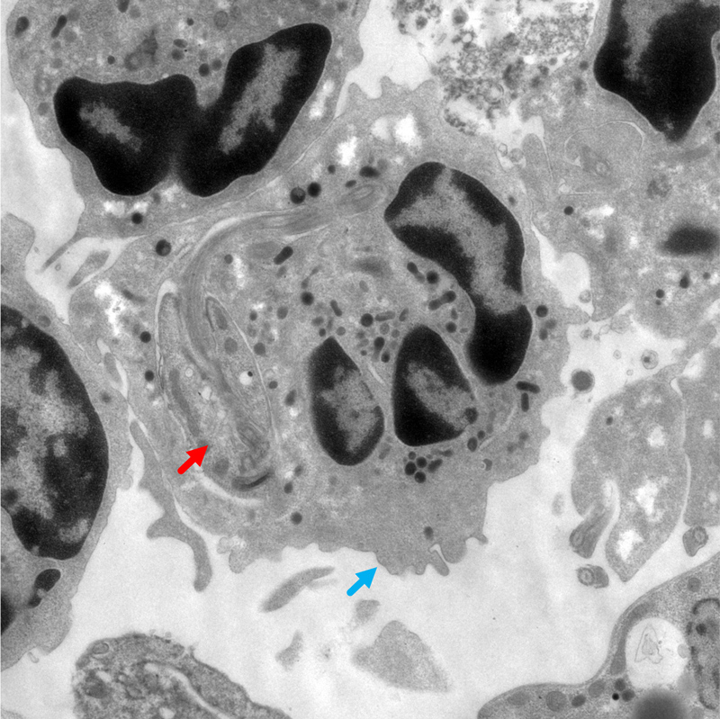 Neutrophil phagocytosis Leishmania parasite