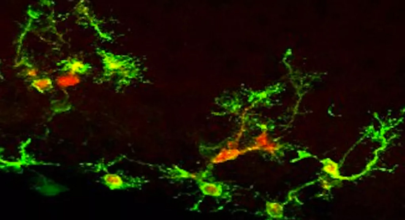 cellules souches neurales de souris